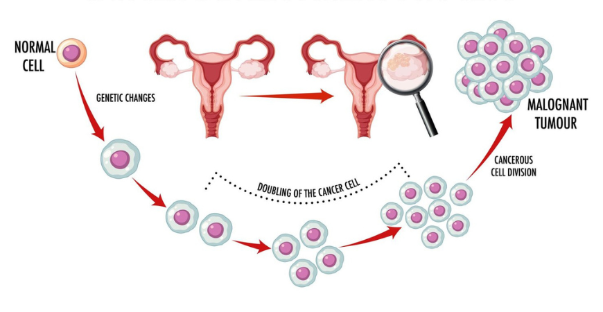 Gynecological Cancers